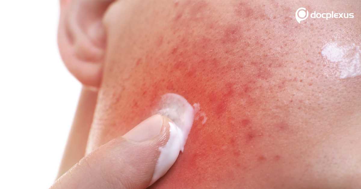 Ingredients Of Beauty Products, Cosmetics May Be Poisonous Warns Use Cautiously