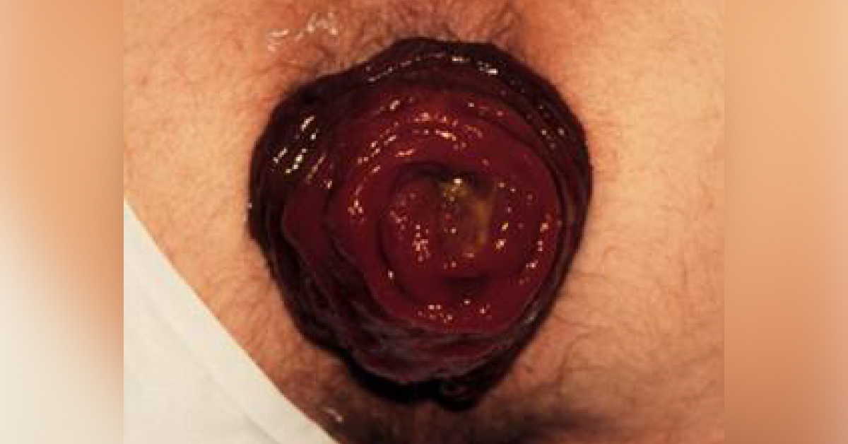 Select Appropriate Surgery