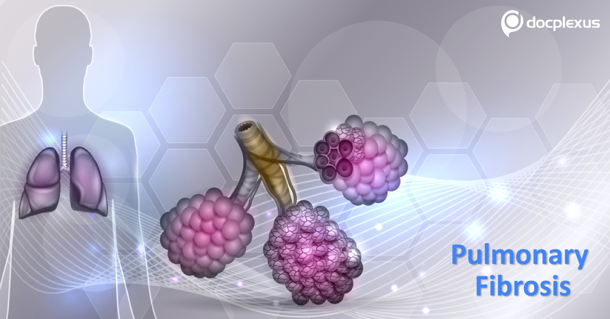 Pathogenesis Of Pulmonary Fibrosis