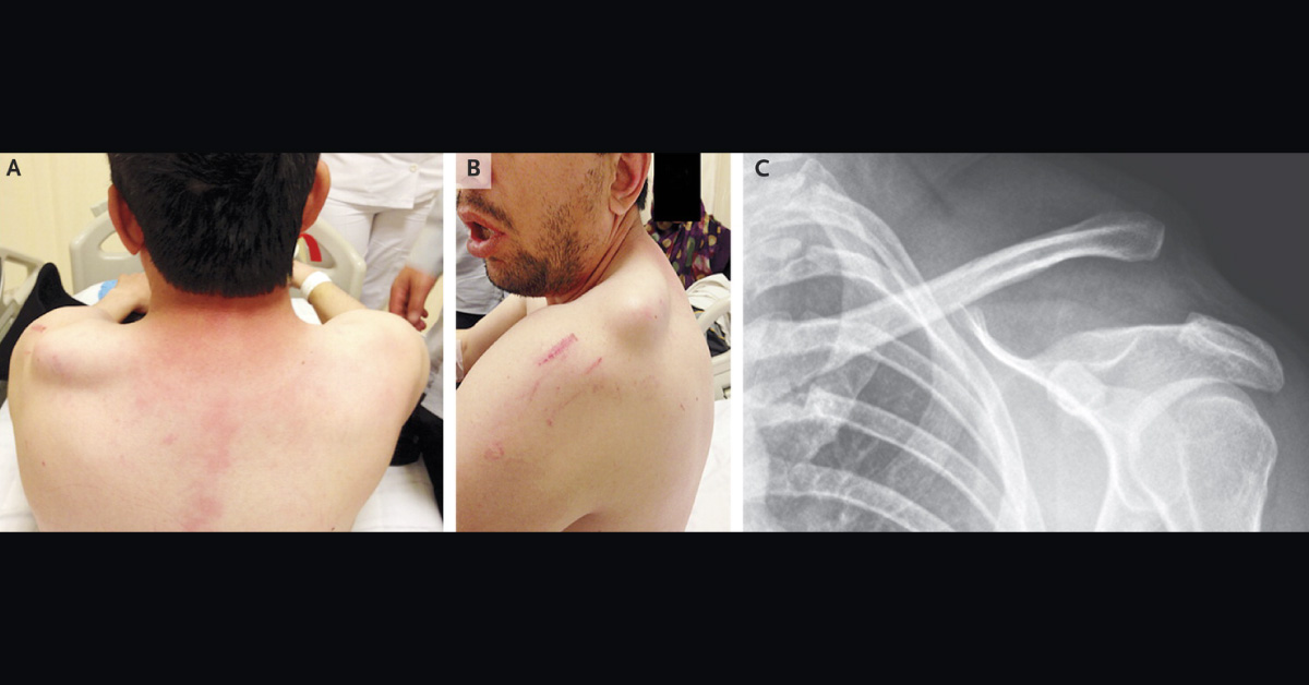 Identify Which Joint Dislocation Is This