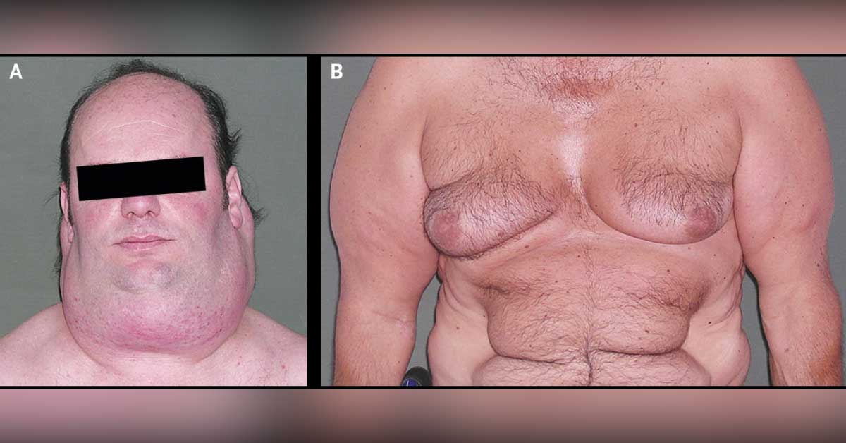 Identify This Rare Condition