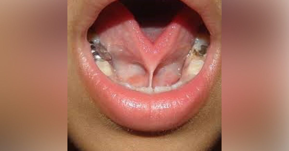 Identify The Condition From Image