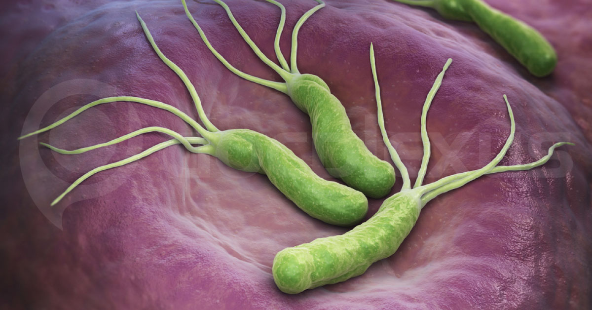 H.pylori- A Myth Or Reality?