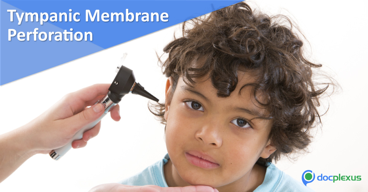 When To Repair Tympanic Membrane Perforations In Pediatrics?