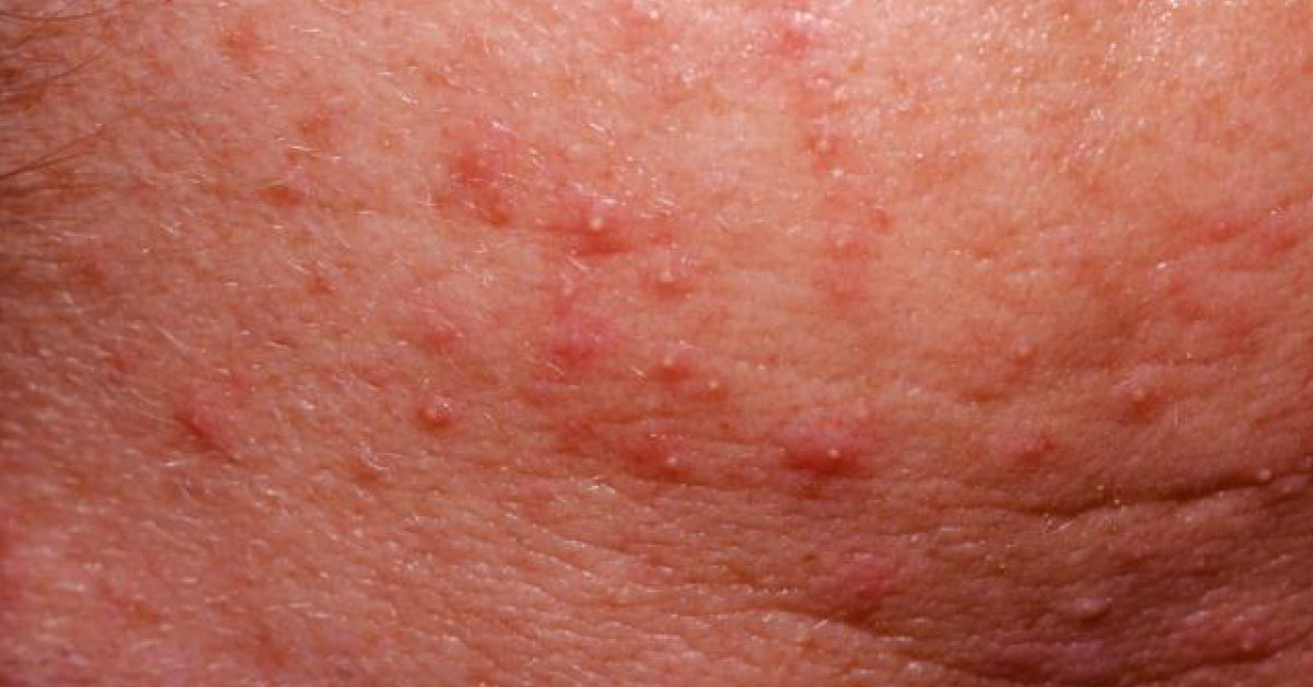 Identify The Condition