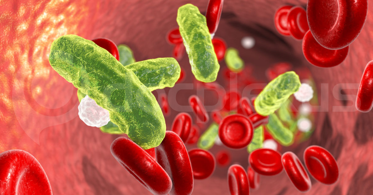 Serum Lactate Level As Important Marker In Sepsis Patients