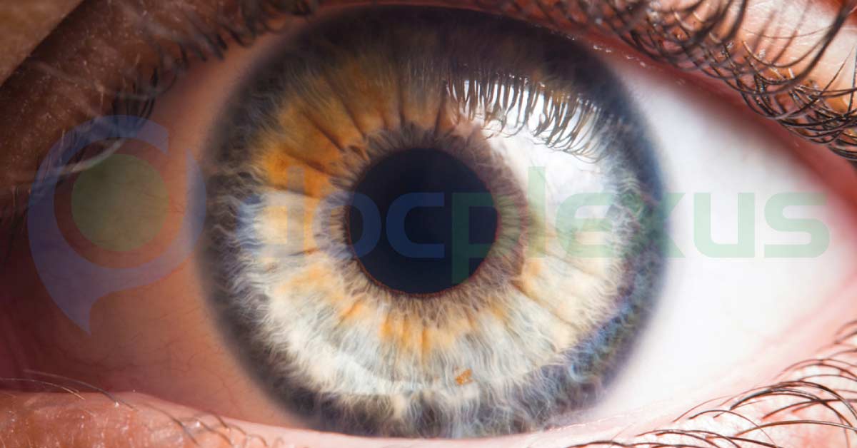 A Brief Review Of Various Ophthalmic Rings