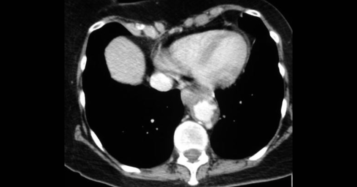 Interpret This CT Scan