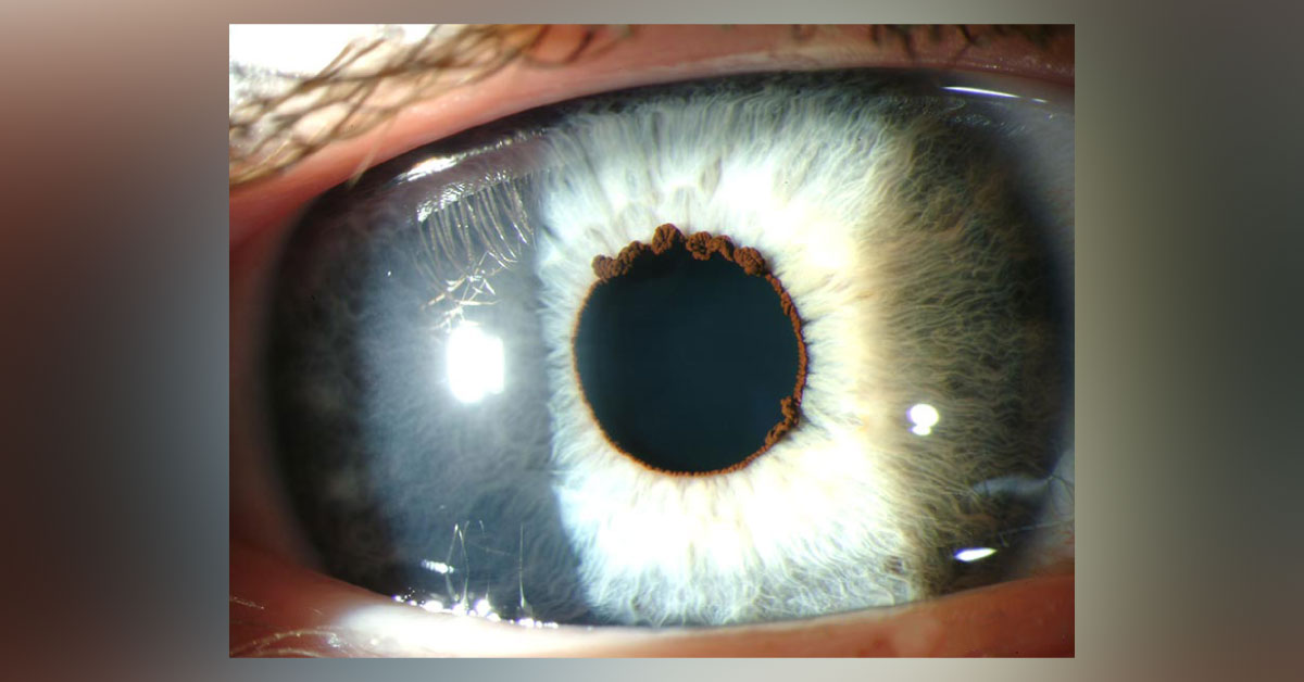 What Is This Condition?