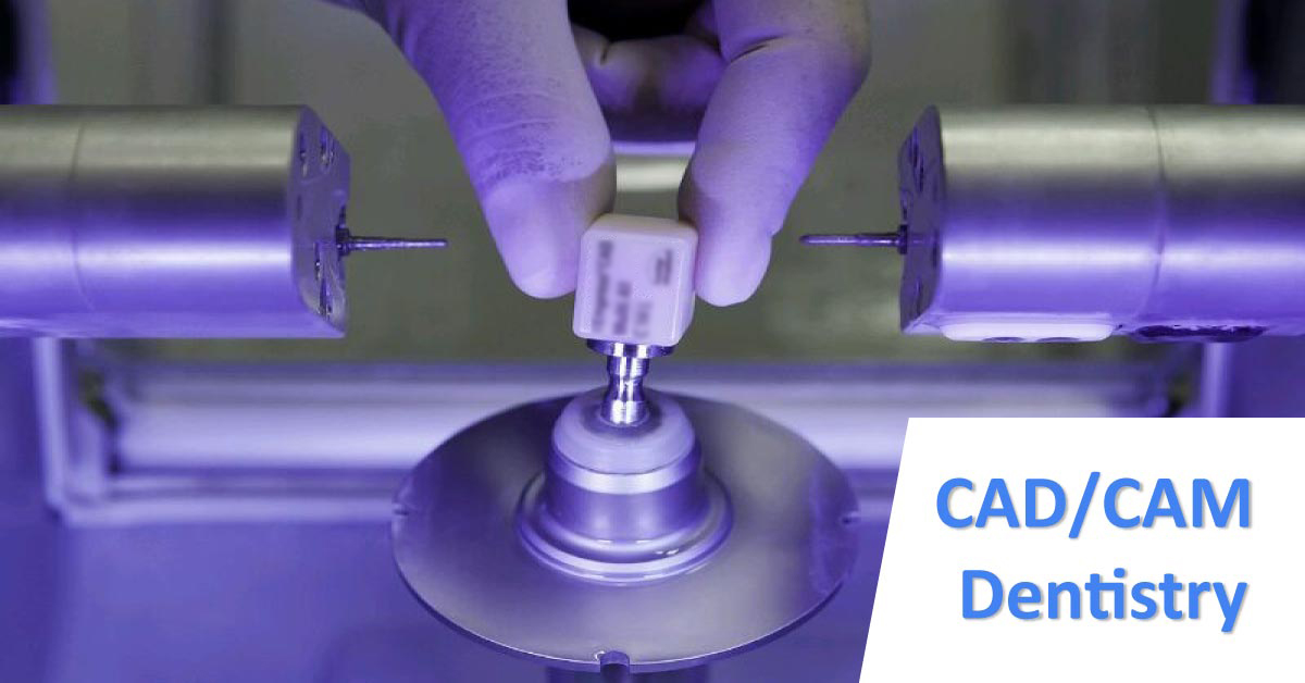 CAD/CAM Dentistry Offers High Accuracy And Compatibility With Pleasing Aesthetics
