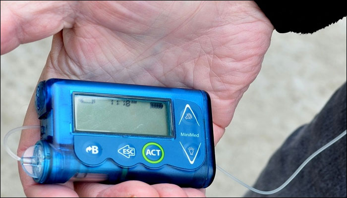 Diabetic Kids Should Use Insulin Pumps Instead Of Injections