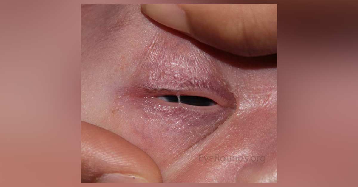 Image Based Diagnosis