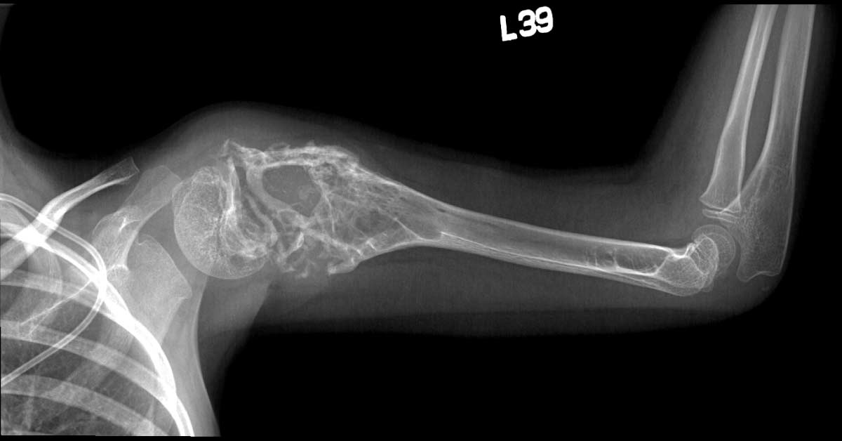 Spot This Underlying Condition