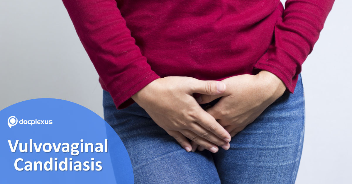 Vulvovaginal Candidiasis: Management Guidelines