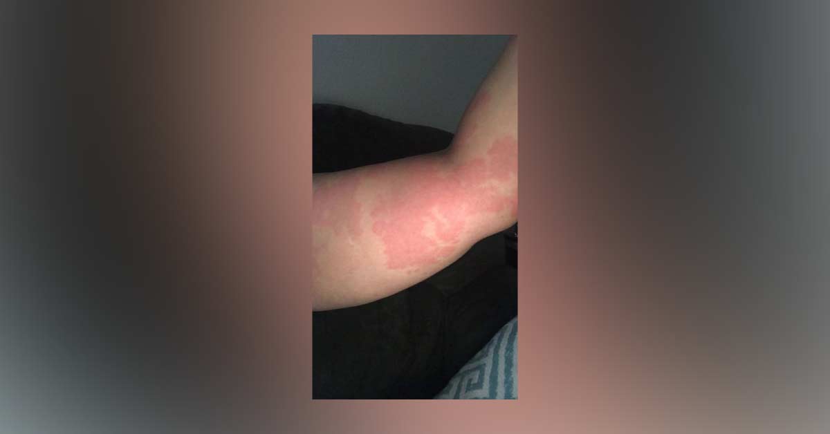 Diagnose The Skin Condition