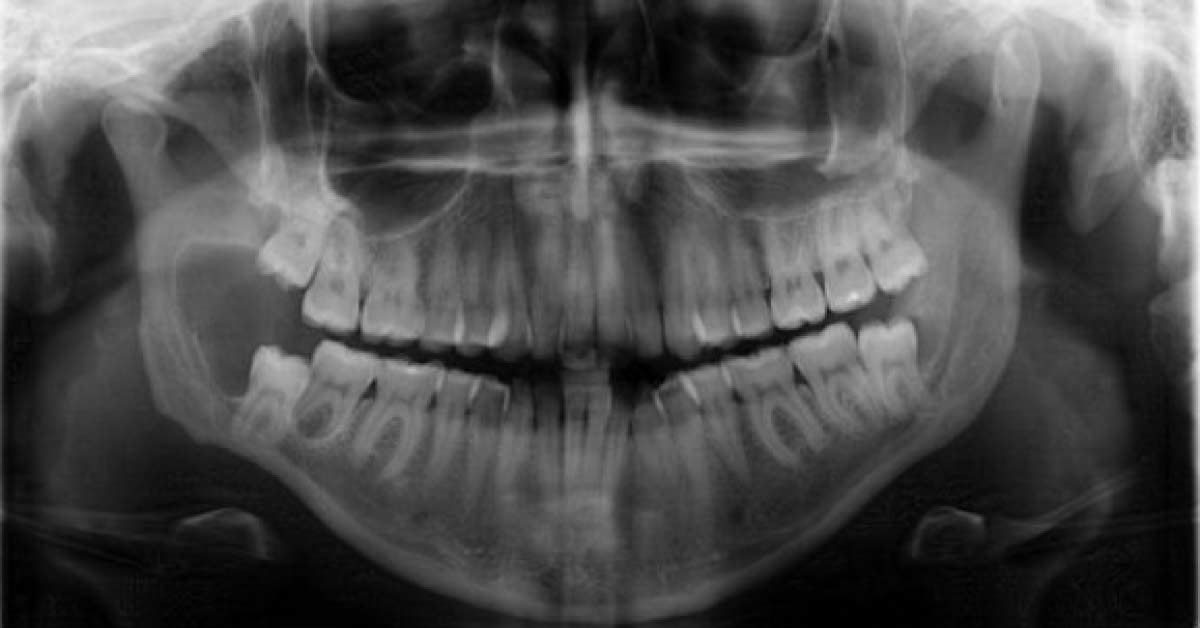 Solve This Case Of Jaw Pain In A Young Female