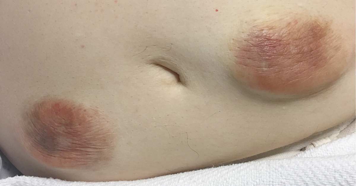Identify This Condition In A Diabetic Patient