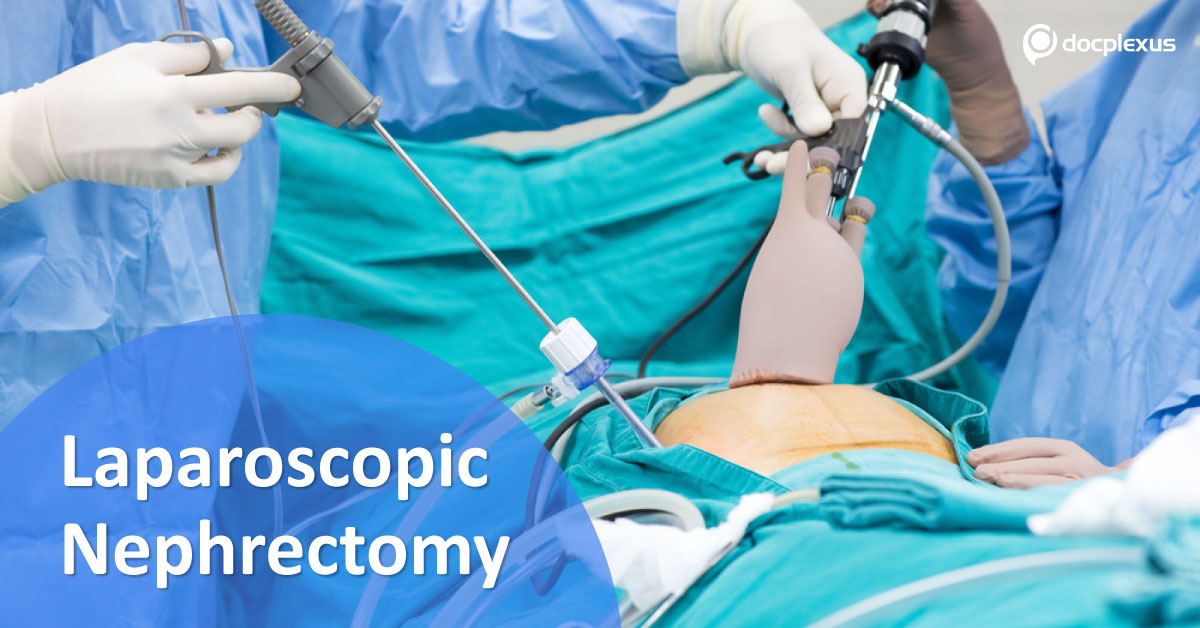 Laparoscopic Nephrectomy