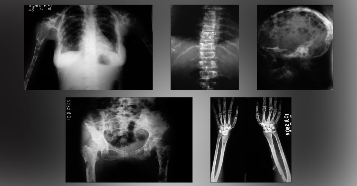 Interpret The Radiological Findings