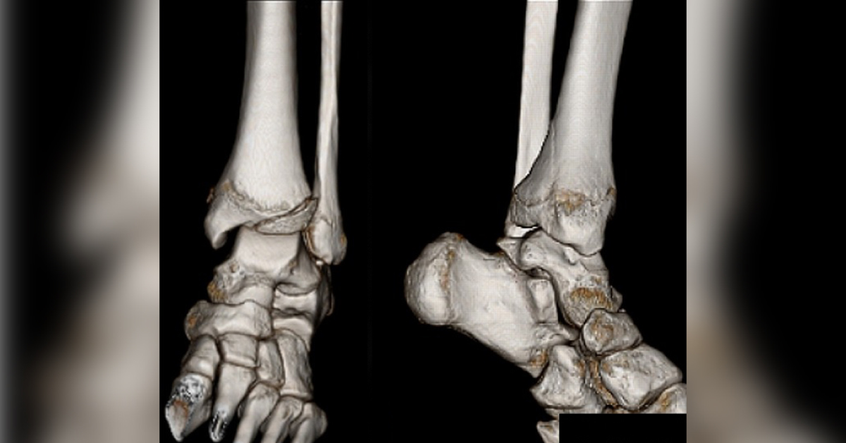 Image Based Diagnosis