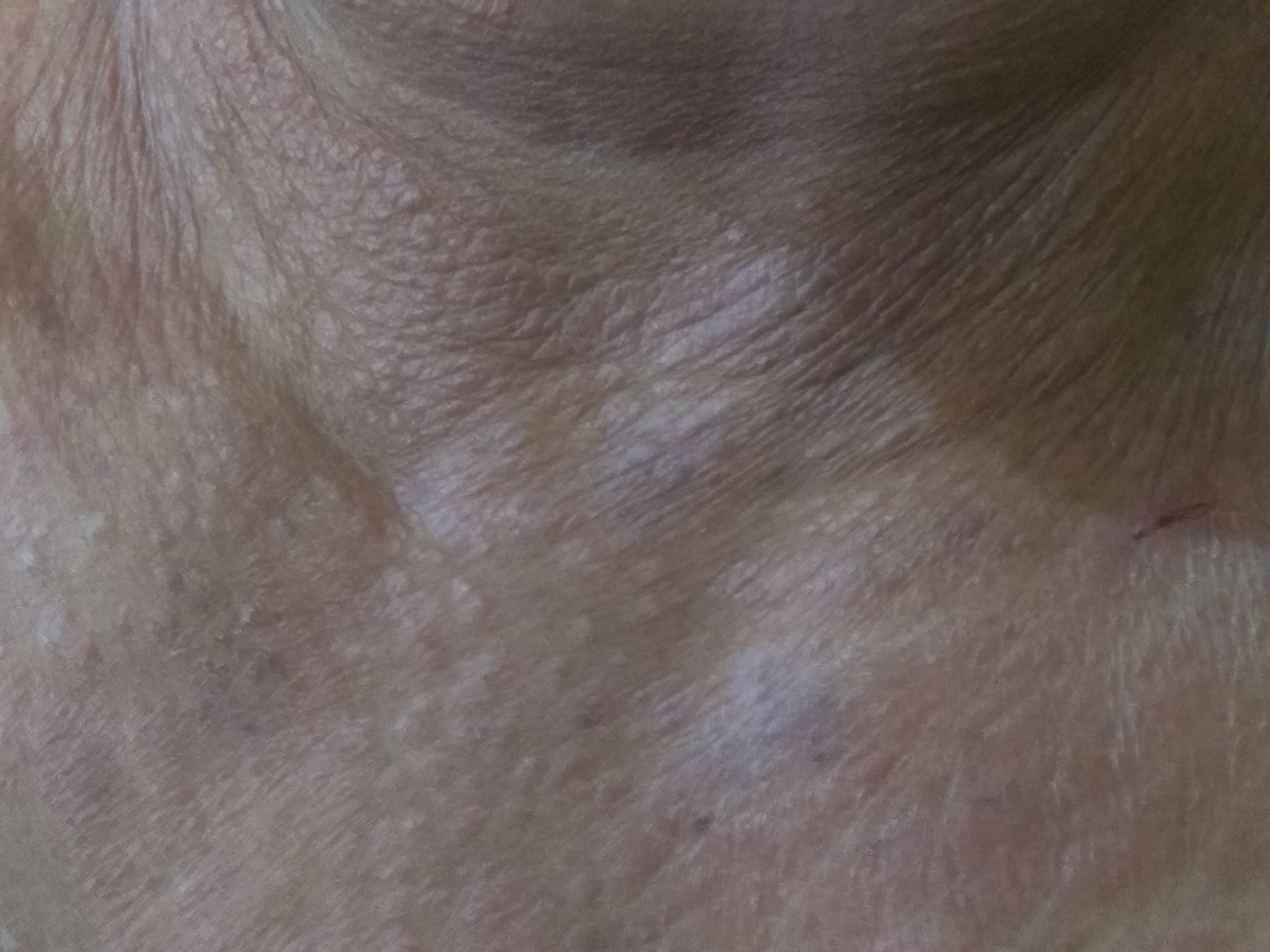 Identify This Skin Condition?