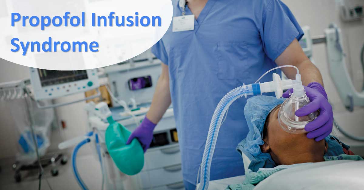 Propofol Infusion Syndrome, A Fatal Complication