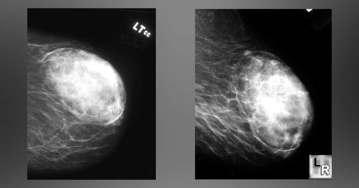 Image Based Diagnosis