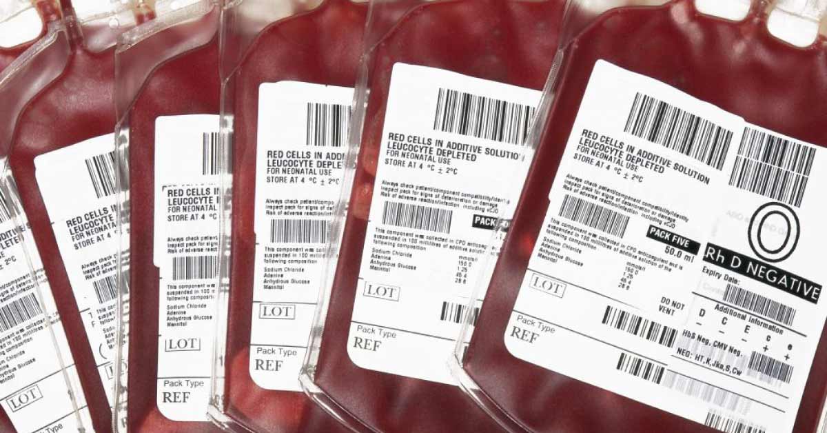 Do allogenic blood transfusion cause infection?