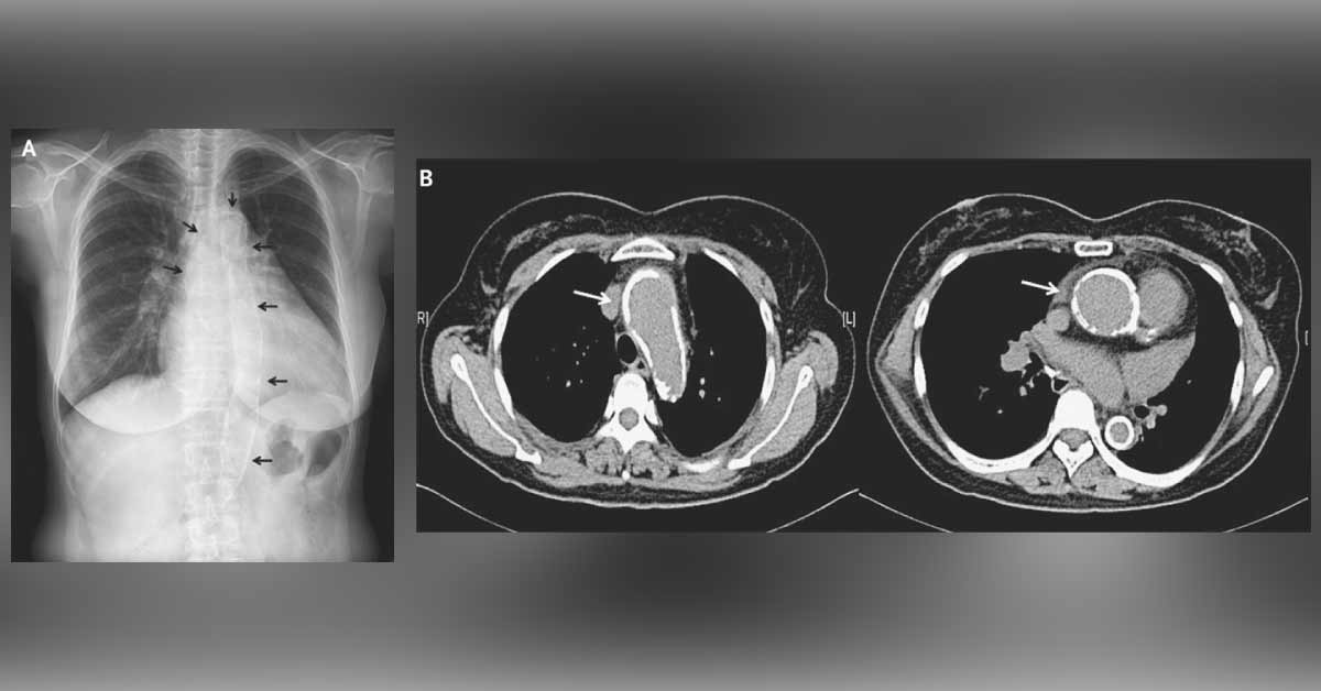 Identify Condition From The Attached Images