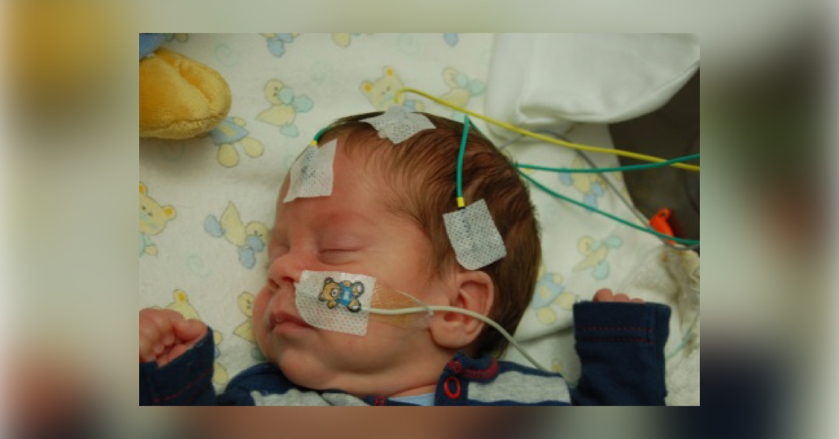 Amplitude Integrated EEG, An Overview