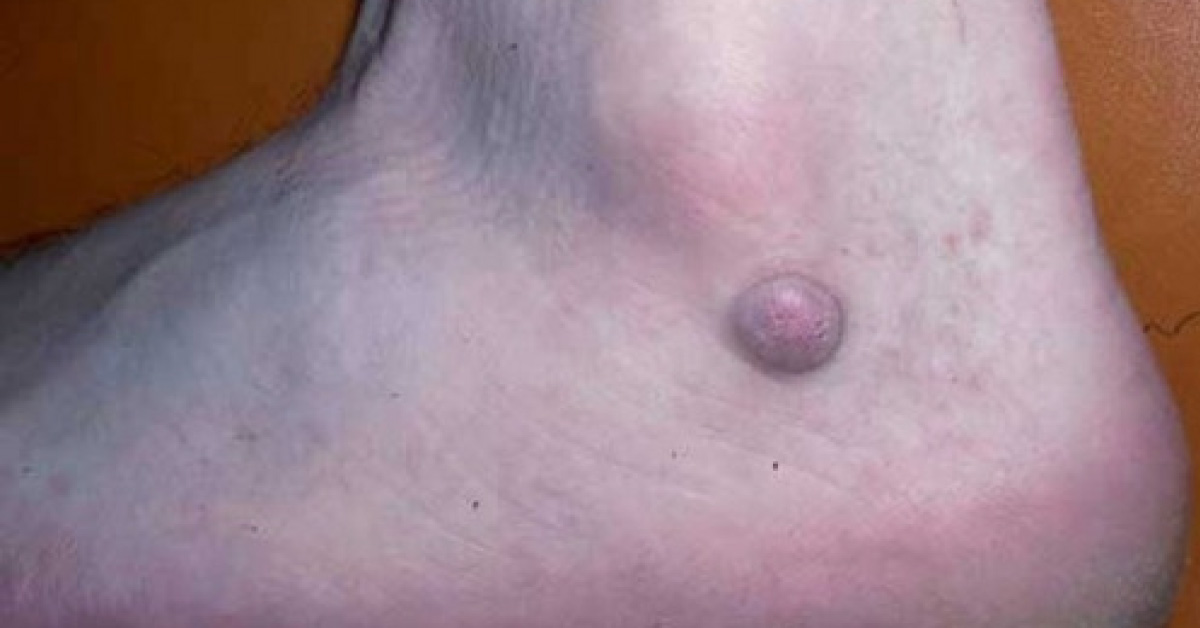 What Is Your Diagnosis?