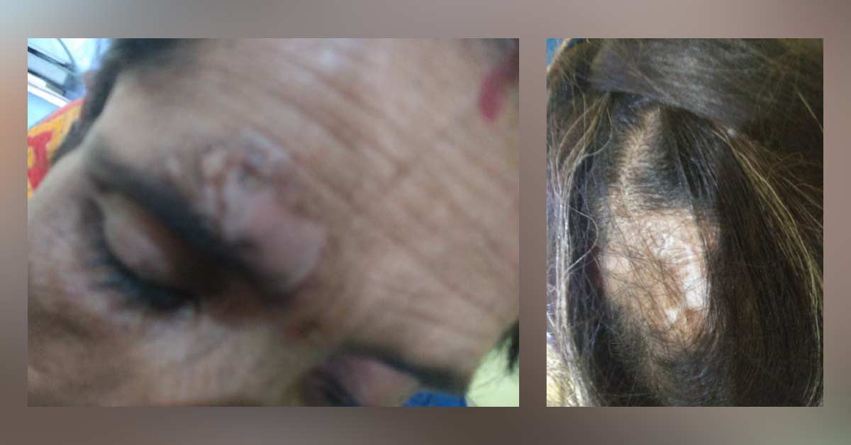 Identify This Condition?