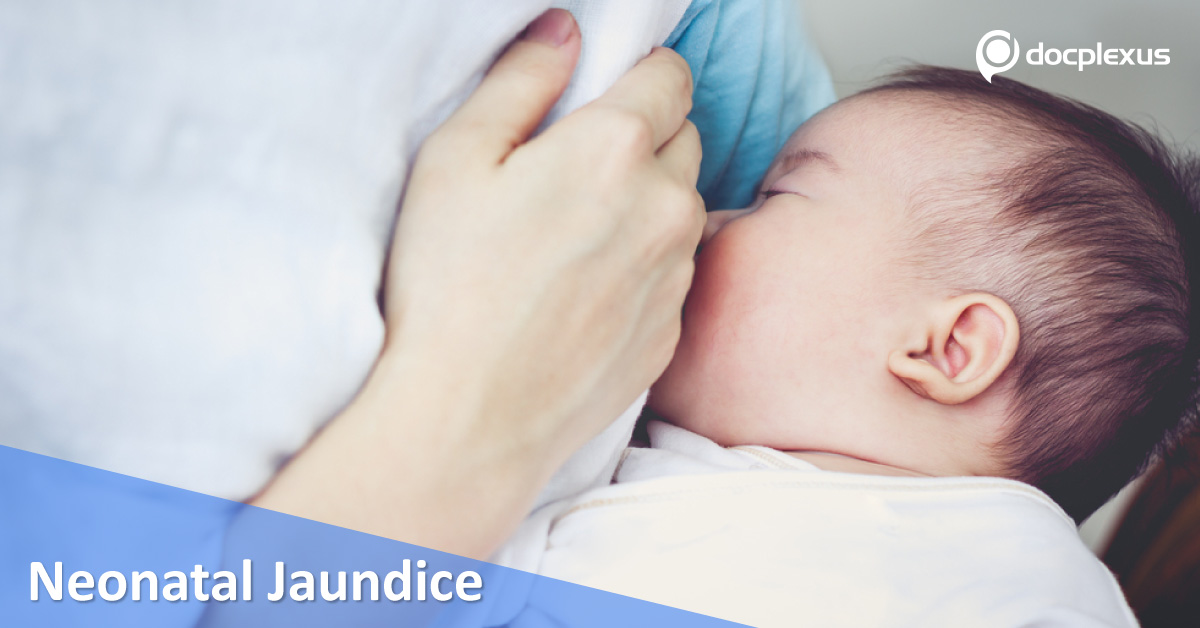 Breastfeeding In Neonatal Jaundice