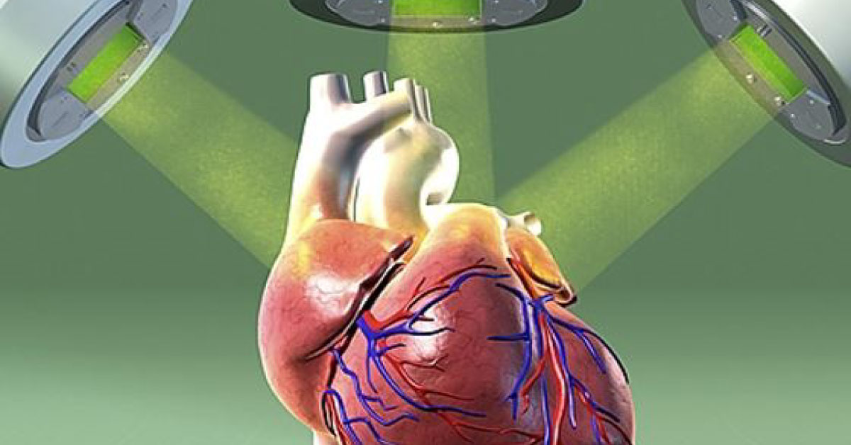 Cardiovascular Side Effects Of Radiotherapy In Breast Cancer