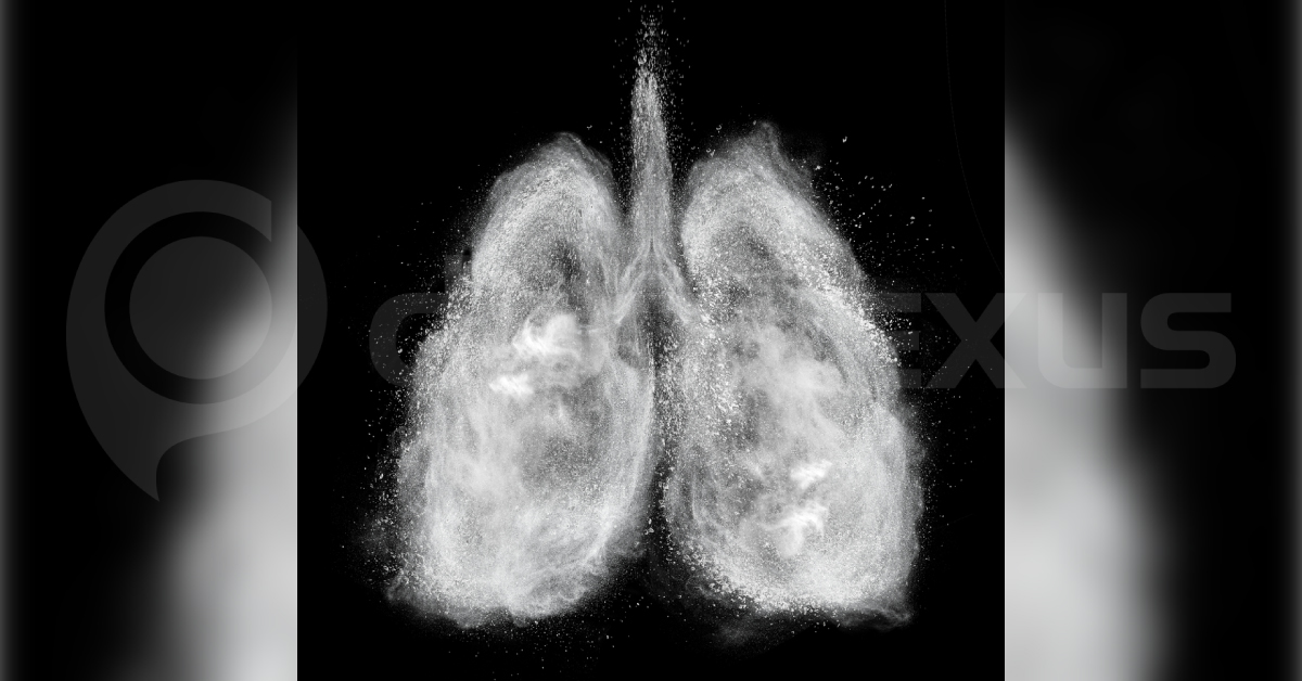 Causes, Diagnosis And Management Of Silicosis