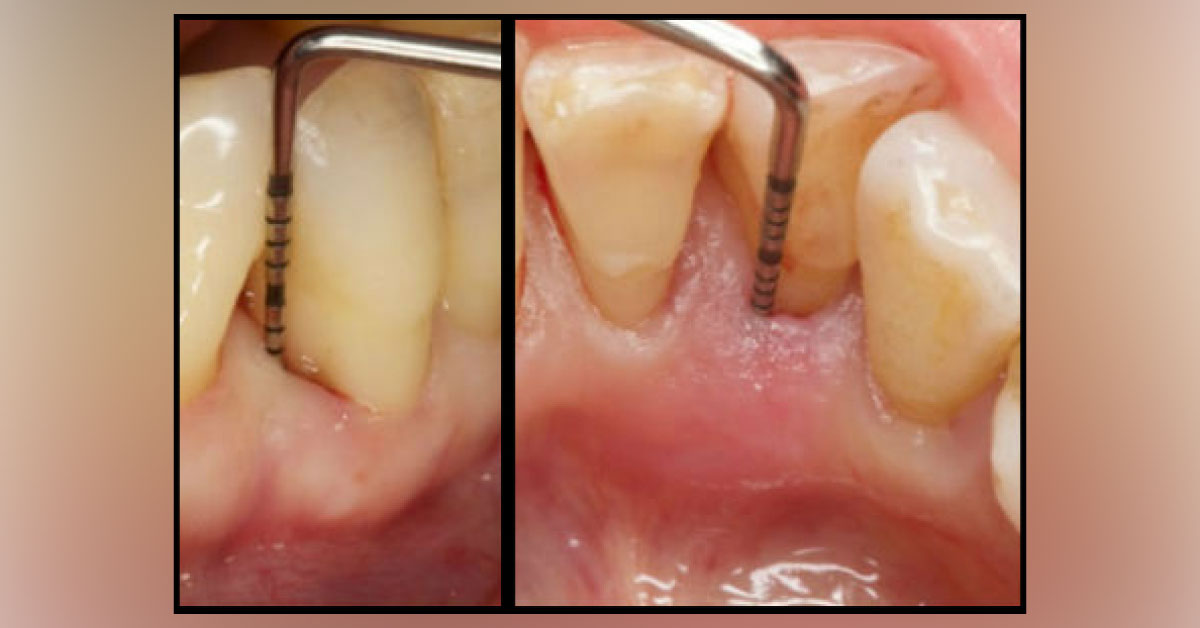 From The Diagnosis To Treatment, Take An Interesting Dental Quiz