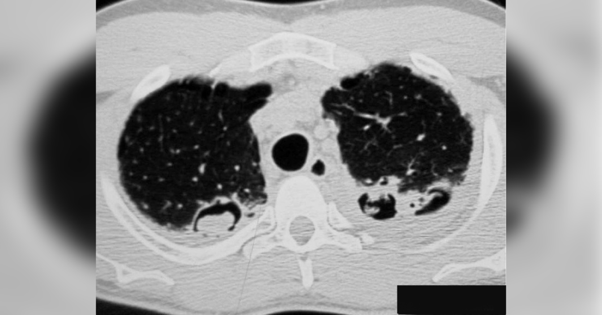 Image Based Diagnosis