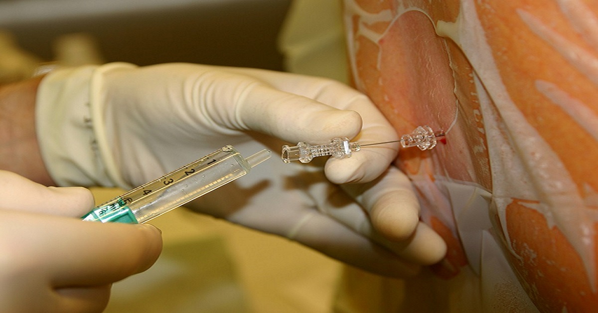 Therapeutic Options For Managing Postdural Puncture Headache