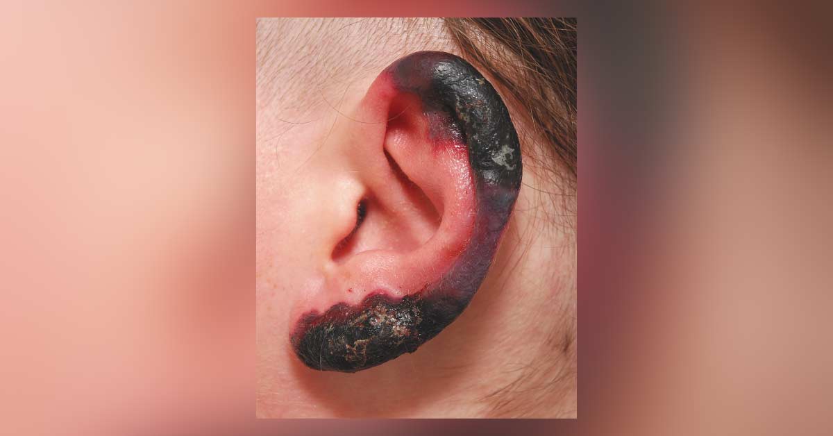 Identify This Condition