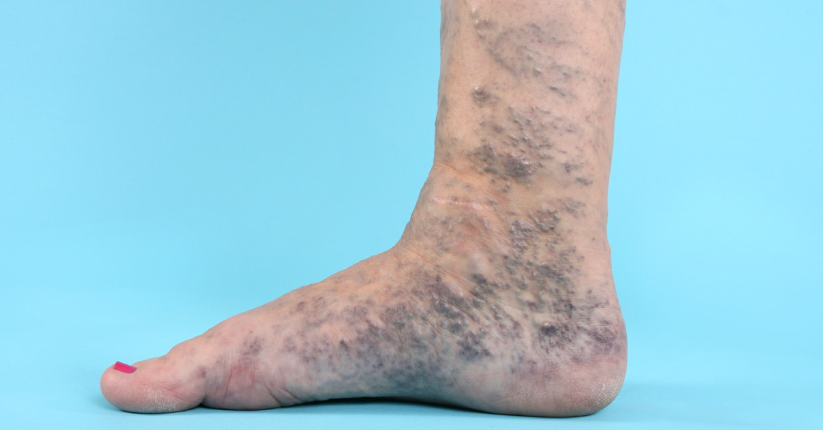 Spot The Condition