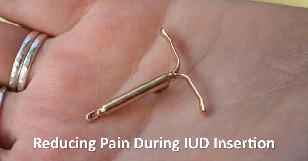 Lidocaine Vs Sham Block For Reducing Pain During IUD Insertion