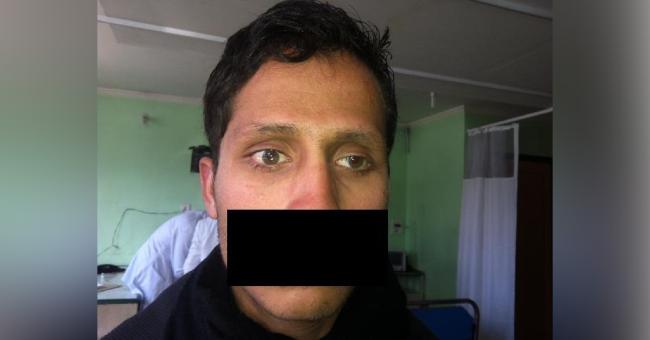 Various Surgical Modalities In The Treatment Of Chronic Dacryocystitis