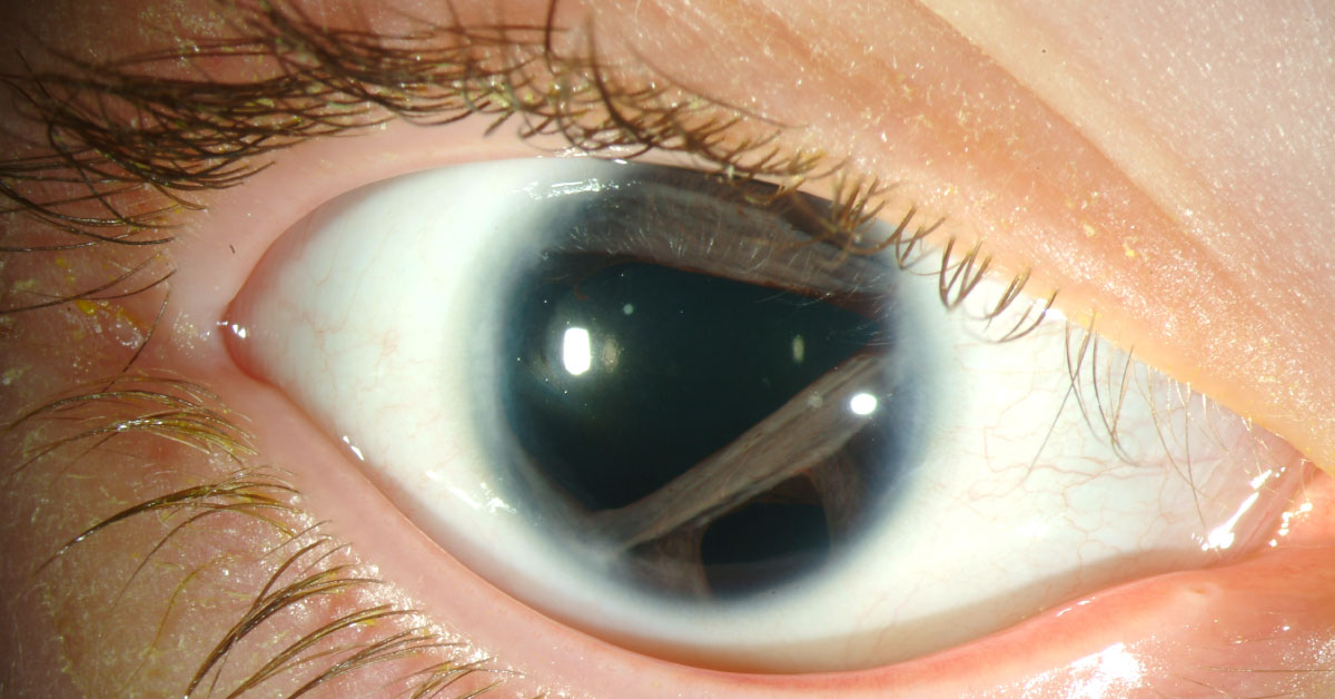 Identify This Condition