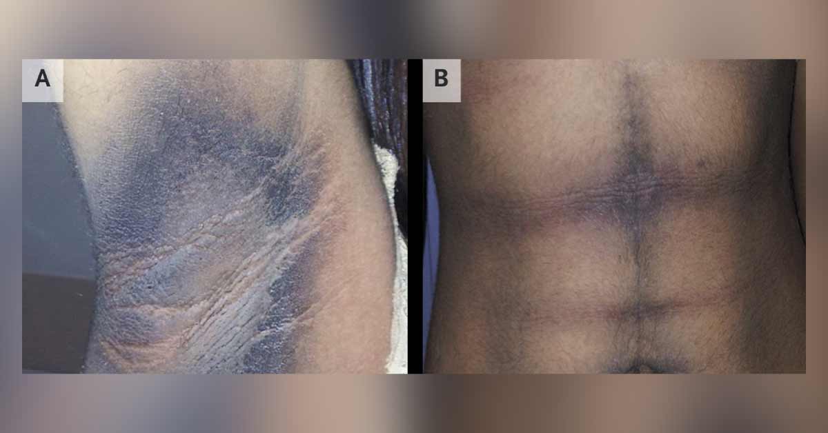 Identify This Condition In A Young Woman