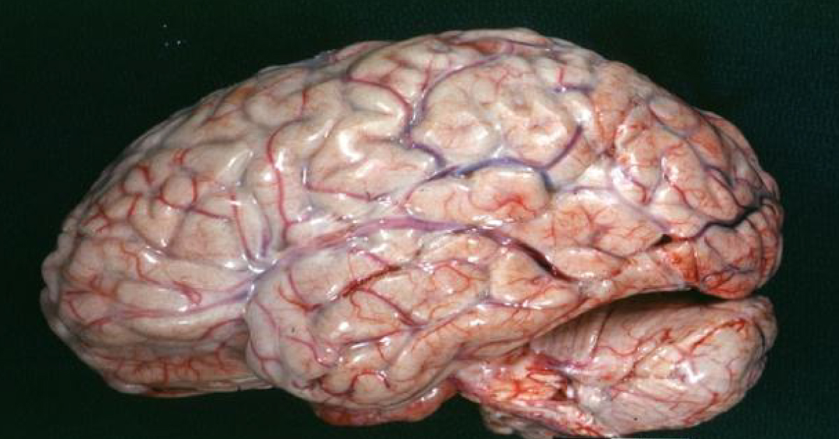 Human Brains Have A Waste Drainage Lymphatic System Too