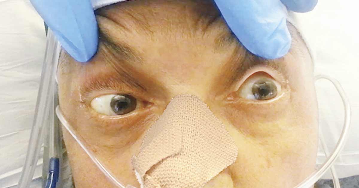 Determine This Neuro Ophthalmic Condition