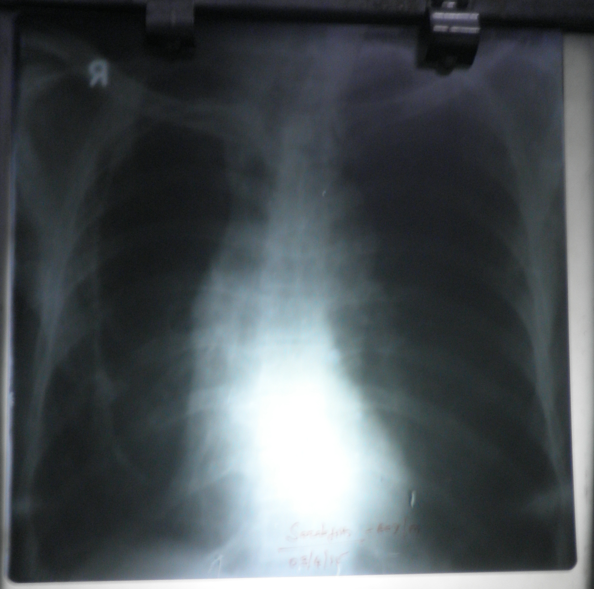 Identify The X- Ray Findings