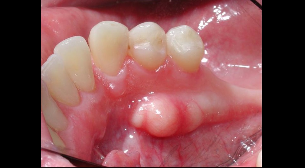Spot The Diagnosis