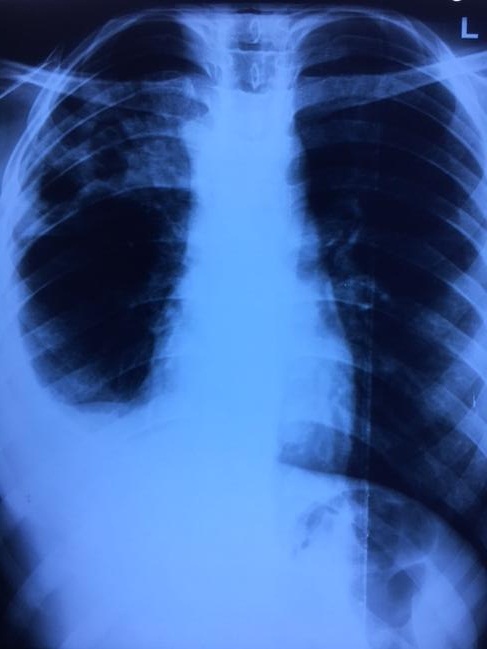 Diagnose The Lesion On X Ray