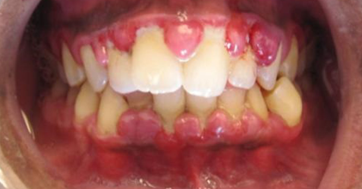 Diagnose This Oral Condition